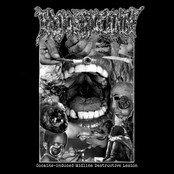 Cocaine-induced Midline Destructive Lesion