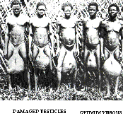 Damaged Testicles - Optimum Vibrosis