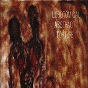 End of the Excruciating Misery