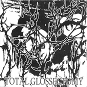Total Glossectomy