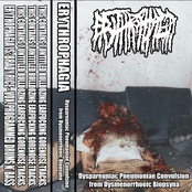 Dyspareuniac Pneumoniae Convulsion From Dysmenorrhoeic Biopsyna