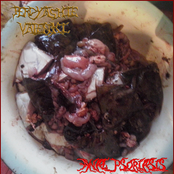 Пердящие Валенки / Anal Psoriasis