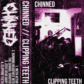 CLIPPING TEETH