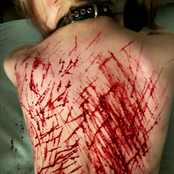 twin sisters' stomachs full of blood