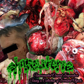 Unwarranted Cranial Separation Using a Collection of Serrated Objects