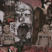 In The Peripheral Margin Of Trauma