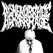 dysmenorrheic hemorrhage