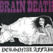 Brain Death