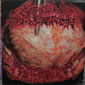 Sarcoma Fermentation / Bacteriophagia