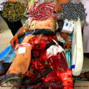massive gore and mutilated disease impact on the human race