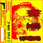 Decompurulent Ulcerator / Emetophagia / Cystoblastosis