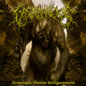 Grotesque Human Disifigurement