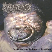 Septicemia Of Deformed Remains