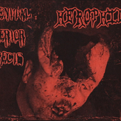 Congenital Interior Defects / Herophilus