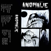 Anomalie