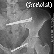 Skeletal