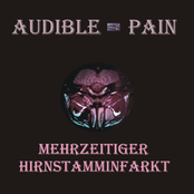 Mehrzeitiger Hirnstamminfarkt