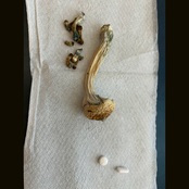 Gradient / NBOMe (Demo)