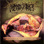 Bowel Stew / Hipermenorrea / Paracoccidioidomicosisproctitissarcomucosis