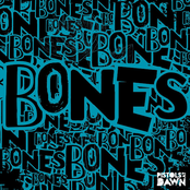 Bones