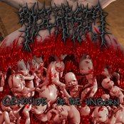 Genocide Of The Unborn (Putrid Pile Split)