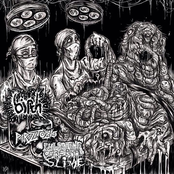Birth / Parazitozis / Pulsating Cerebral Slime