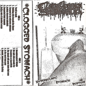 Hyperbulimic Stomach Rupture