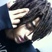 my tongue tie d im trauma Tized