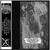 Bodily Loss Of Slipping Skin And Trapped Fluids And Gases