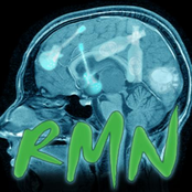 Rmn