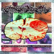 Candidamycosis Pulmonum