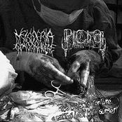 Two Ways To Torture A Rotten Body With Surgery