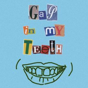 Gap in My Teeth