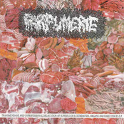 Transmundane And Unprofessional Delocation Of Superfluous Extremities, Organs And Rare Tissues E.P.