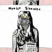 Everything Is Contagious by Myelin Sheaths