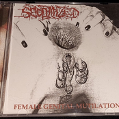 Female Genital Mutilation