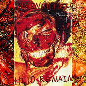HYMENOLEPIASIS​/​/​CHILD REMAINS SPLIT