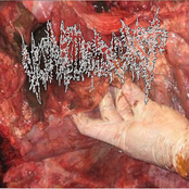 Vomitologyst