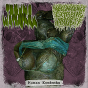 Human Kombucha