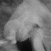 Humors of the Blood and Skin