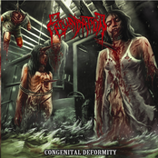 Congenital Deformity