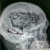 coup dcouteau dans face promo ep