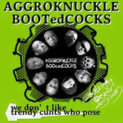 we don't like trendy cunts who pose