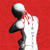 bite marks