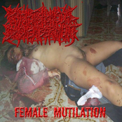 Female Mutilation