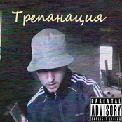 Трепанация