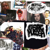 Mental Abortion / Gastric Mucosa