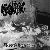 Severed From Every Limb