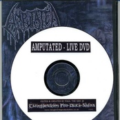 Live Amputation!