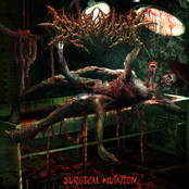 Surgical Mutation
